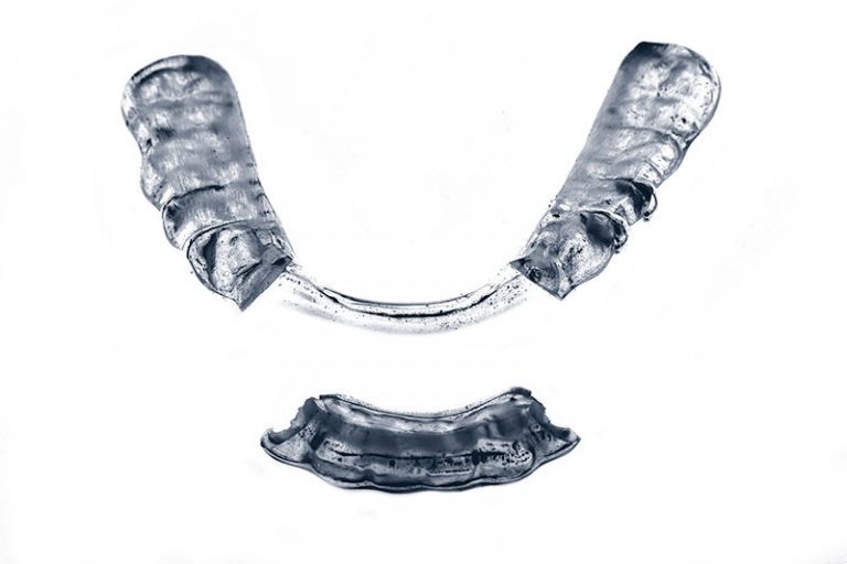 Angepasste CMD Schiene aus Zahnarztpraxis Asamhof in München